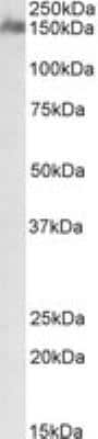 Western Blot: CSMD1 Antibody [NBP2-29341]