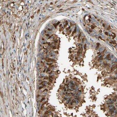 Immunohistochemistry-Paraffin: CSMD2 Antibody [NBP1-93569]