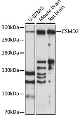 Western Blot: CSMD2 AntibodyAzide and BSA Free [NBP2-92141]