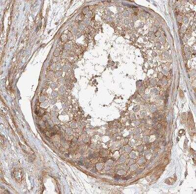 Immunohistochemistry-Paraffin: CSMD3 Antibody [NBP1-86371]