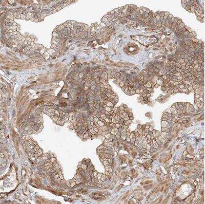 Immunohistochemistry-Paraffin: CSMD3 Antibody [NBP1-86371]