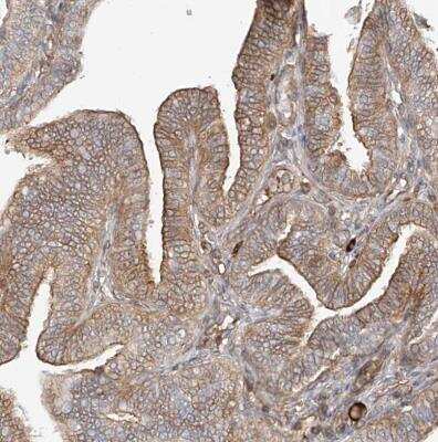 Immunohistochemistry-Paraffin: CSMD3 Antibody [NBP1-86371]