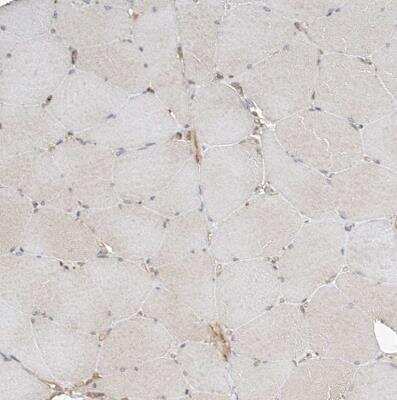 Immunohistochemistry-Paraffin: CSMD3 Antibody [NBP1-86371]