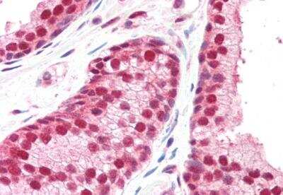 Immunohistochemistry-Paraffin: CSN1 Antibody [NB100-1237]