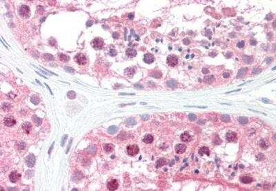 Immunohistochemistry-Paraffin: CSN1 Antibody [NB100-1237]