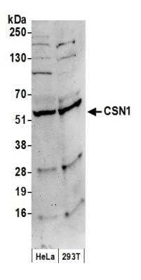 Western Blot: CSN1 Antibody [NB100-362]