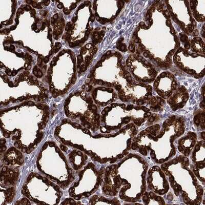 Immunohistochemistry-Paraffin: CSN3 Antibody [NBP1-85436]