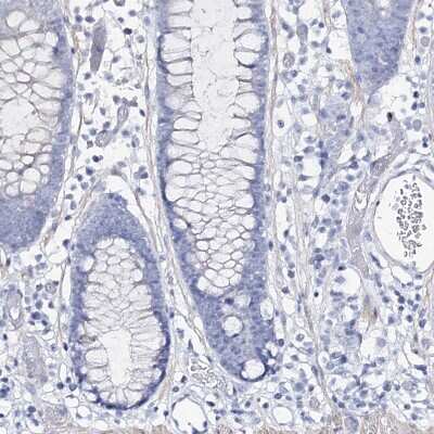 Immunohistochemistry-Paraffin: CSN3 Antibody [NBP1-85436]
