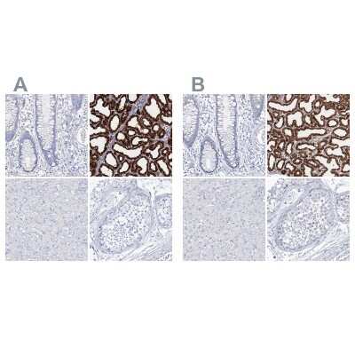 Immunohistochemistry-Paraffin: CSN3 Antibody [NBP1-85436]