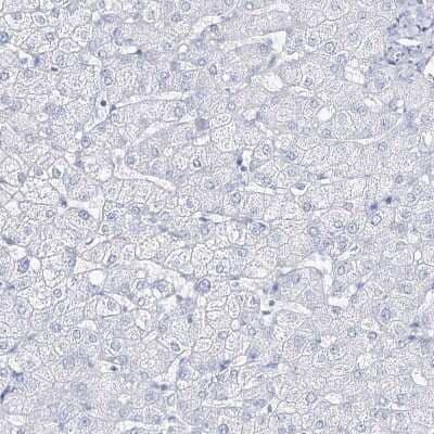 Immunohistochemistry-Paraffin: CSN3 Antibody [NBP1-85436]