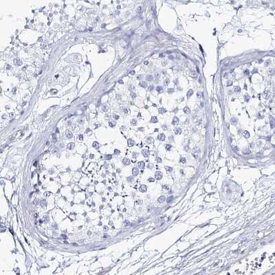 Immunohistochemistry-Paraffin: CSN3 Antibody [NBP1-85436]