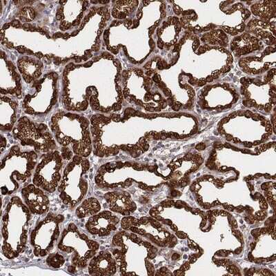 Immunohistochemistry-Paraffin: CSN3 Antibody [NBP2-58781]