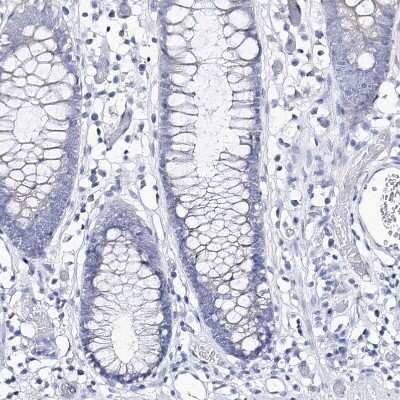 Immunohistochemistry-Paraffin: CSN3 Antibody [NBP2-58781]