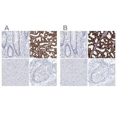Immunohistochemistry-Paraffin: CSN3 Antibody [NBP2-58781]