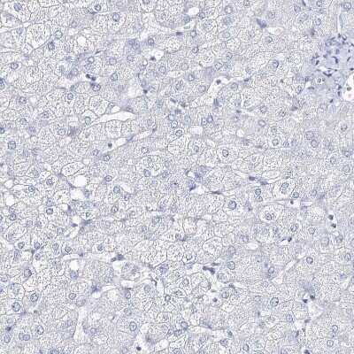 Immunohistochemistry-Paraffin: CSN3 Antibody [NBP2-58781]