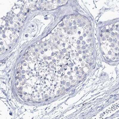 Immunohistochemistry-Paraffin: CSN3 Antibody [NBP2-58781]