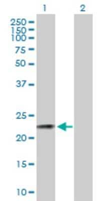 Western Blot: CSN3 Antibody [H00001448-B01P]