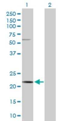 Western Blot: CSN3 Antibody [H00001448-D01P]