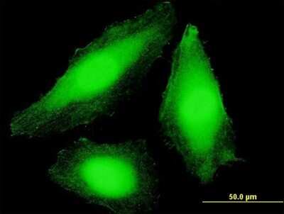 Immunocytochemistry/ Immunofluorescence: CSN7b Antibody [H00064708-B01P]