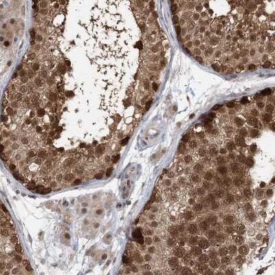 Immunohistochemistry: CSN7b Antibody [NBP2-38214]
