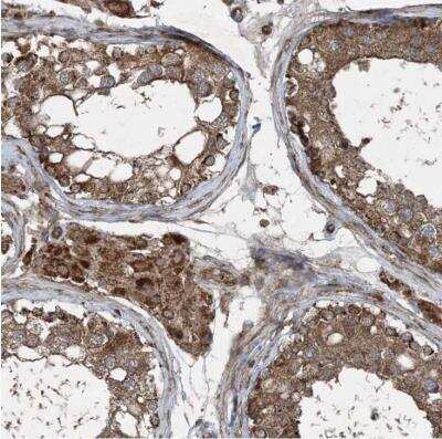 Immunohistochemistry-Paraffin: CSN7b Antibody [NBP1-85433]