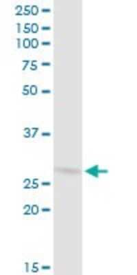 Western Blot: CSN7b Antibody [H00064708-B01P]