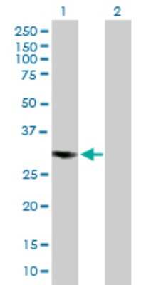 Western Blot: CSN7b Antibody [H00064708-B01P]