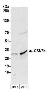 Western Blot: CSN7b Antibody [NB100-461]