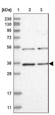 Western Blot: CSN7b Antibody [NBP1-85433]