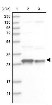 Western Blot: CSN7b Antibody [NBP2-38214]