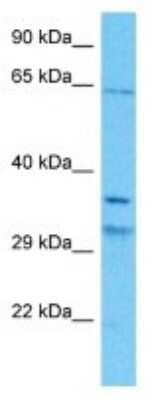 Western Blot: CSN7b Antibody [NBP3-10829]