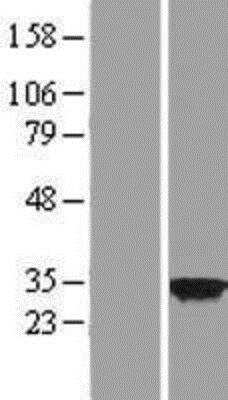 Western Blot: CSN7b Overexpression Lysate [NBP2-06417]