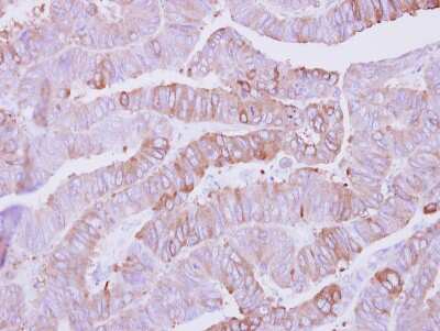 Immunohistochemistry-Paraffin: CSNK1A1L Antibody [NBP2-16020]