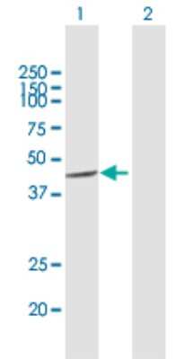 Western Blot: CSNK1A1L Antibody [H00122011-B03P]