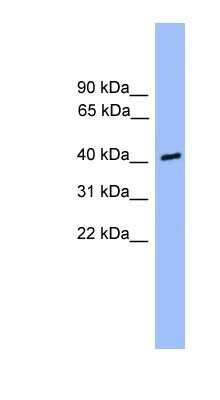 Western Blot: CSNK1A1L Antibody [NBP1-79514]