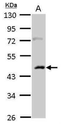 Western Blot: CSNK1A1L Antibody [NBP2-16020]