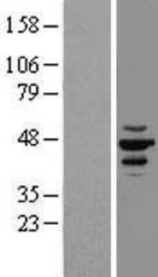 Western Blot: Casein Kinase 1 epsilon Overexpression Lysate [NBL1-09531]