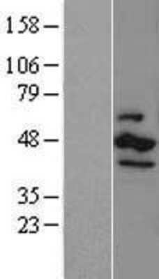 Western Blot: Casein Kinase 1 epsilon Overexpression Lysate [NBL1-09532]