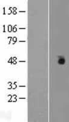 Western Blot: Casein Kinase 1 gamma Overexpression Lysate [NBP2-06482]