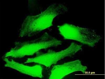 Immunocytochemistry/ Immunofluorescence: CSP Antibody [H00080331-B01P]