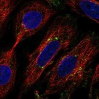 Immunocytochemistry/ Immunofluorescence: CSP Antibody [NBP3-17698]