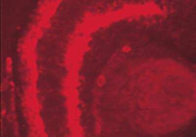 Immunohistochemistry: CSP Antibody [NBP2-88985]