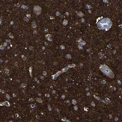 Immunohistochemistry-Paraffin: CSP Antibody [NBP1-87974]