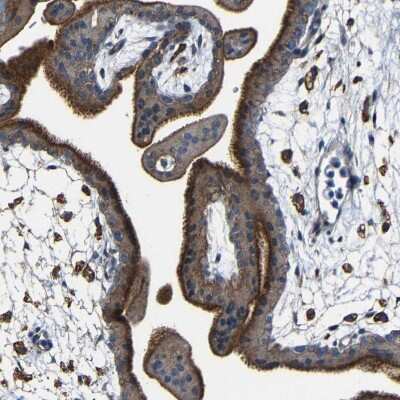 Immunohistochemistry-Paraffin: CSP Antibody [NBP1-87974]
