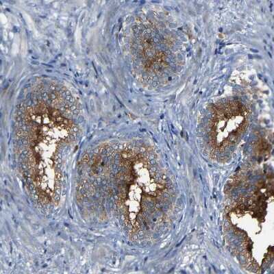 Immunohistochemistry-Paraffin: CSP Antibody [NBP1-87974]