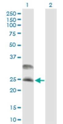 Western Blot: CSP Antibody [H00080331-B01P]
