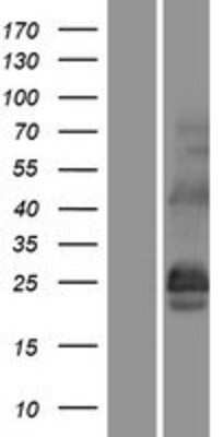 Western Blot: CSP Overexpression Lysate [NBP2-11584]