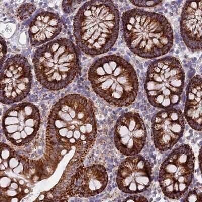 Immunohistochemistry-Paraffin: NG2/MCSP Antibody [NBP1-94154]