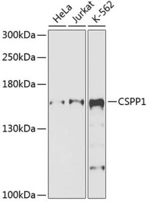 Western Blot: CSPP AntibodyBSA Free [NBP2-92596]