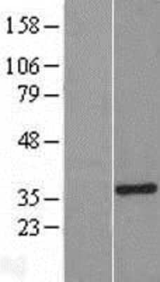 Western Blot: SULT1A3 Overexpression Lysate [NBP2-11019]